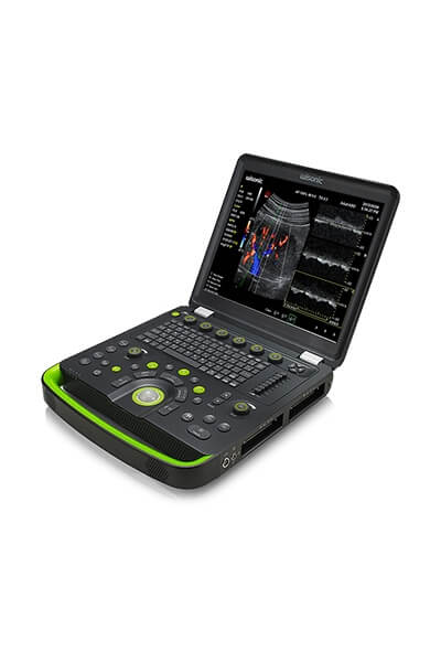 Przenośny/Mobilny Aparat Wisonic Clover 60 Przenośny/Mobilny Aparat Wisonic Clover 60